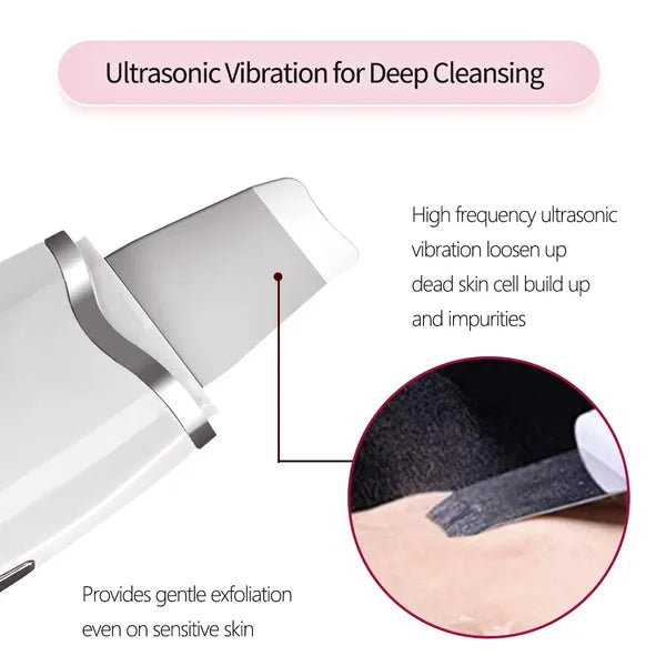 3 in 1 Ultrasonic Facial Spatula For Deep Cleansing Electric Ultrasonic Skin - Image 3
