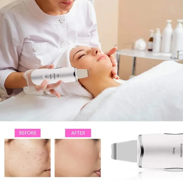 3 in 1 Ultrasonic Facial Spatula For Deep Cleansing Electric Ultrasonic Skin - Image 5